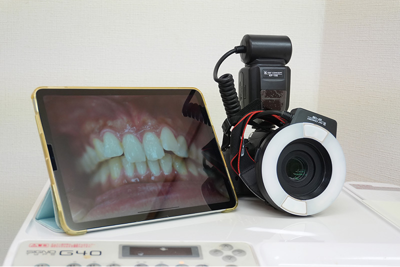 口腔内カメラ